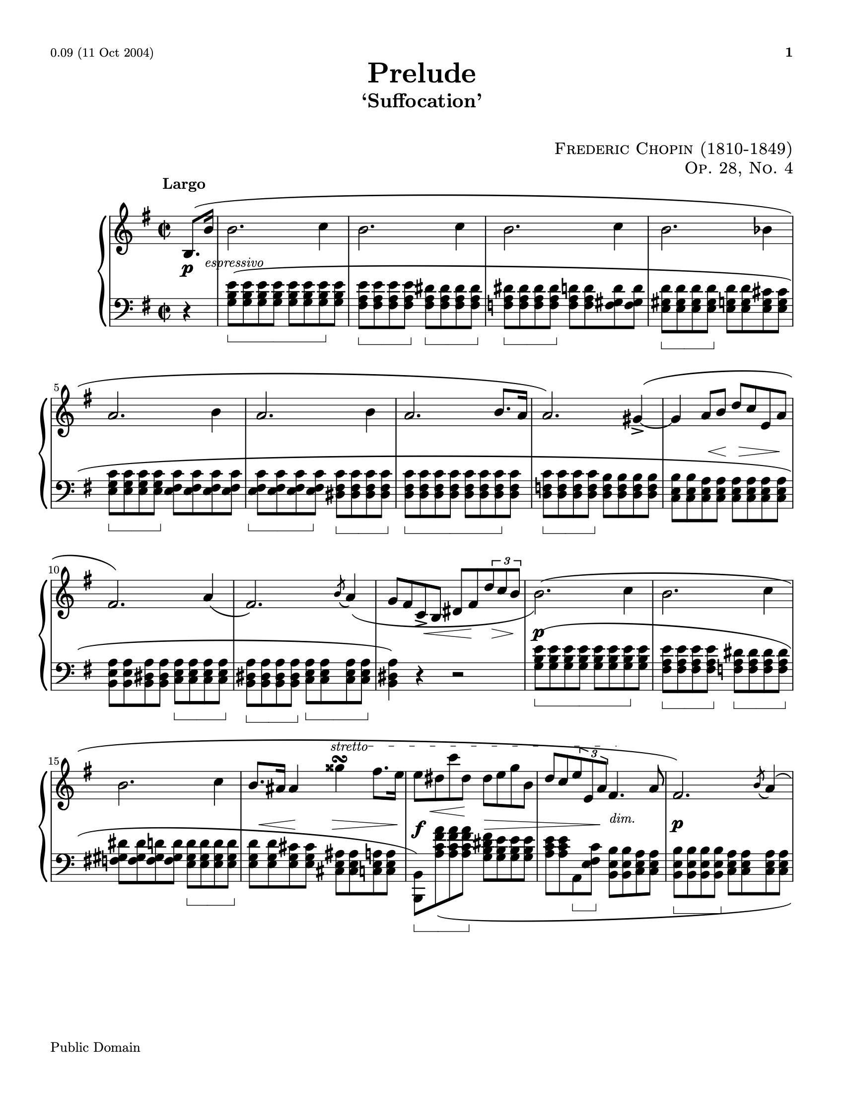 Prelude, Op. 28, No. 4 in E minor sheet music — page 1